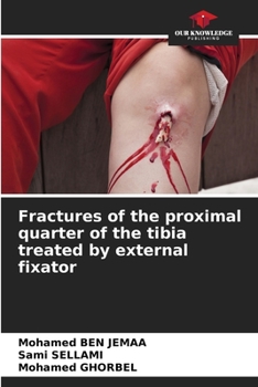 Paperback Fractures of the proximal quarter of the tibia treated by external fixator Book