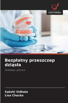 Bezplatny przeszczep dziasla (Polish Edition)