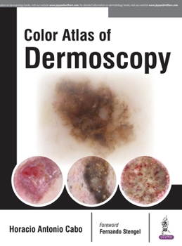 Hardcover Color Atlas of Dermoscopy Book