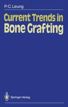 Paperback Current Trends in Bone Grafting Book