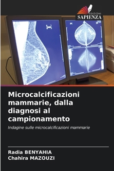 Microcalcificazioni mammarie, dalla diagnosi al campionamento (Italian Edition)