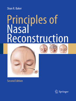 Paperback Principles of Nasal Reconstruction Book