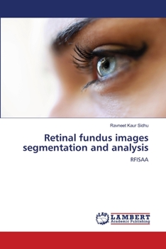 Paperback Retinal fundus images segmentation and analysis Book