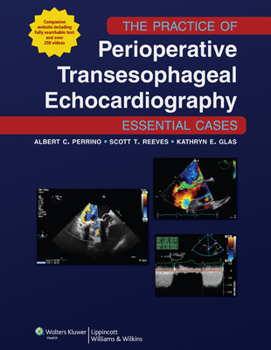 Hardcover The Practice of Perioperative Transesophageal Echocardiography: Essential Cases Book