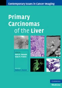 Electronics Primary Carcinomas of the Liver Book