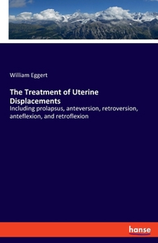 Paperback The Treatment of Uterine Displacements: Including prolapsus, anteversion, retroversion, anteflexion, and retroflexion Book