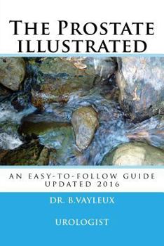Paperback The Prostate illustrated: In 10 points Book