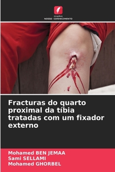 Paperback Fracturas do quarto proximal da tíbia tratadas com um fixador externo [Portuguese] Book