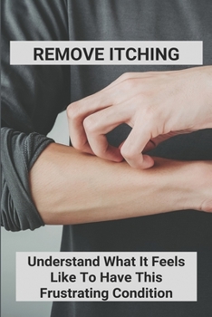 Paperback Remove Itching: Understand What It Feels Like To Have This Frustrating Condition: Stretch Marks Itch While Losing Weight Book