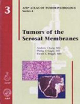 Hardcover Tumors of the Serosal Membranes Book