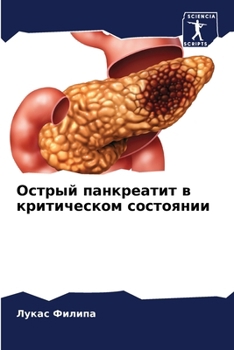 Paperback Острый панкреатит в крит [Russian] Book