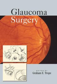 Hardcover Glaucoma Surgery [With DVD] Book