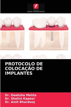 Paperback Protocolo de Colocação de Implantes [Portuguese] Book