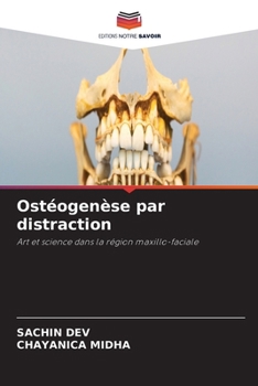 Paperback Ostéogenèse par distraction [French] Book