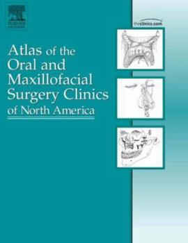 Hardcover Mandibular Reconstruction, an Issue of Atlas of the Oral and Maxillofacial Surgery Clinics: Volume 14-2 Book