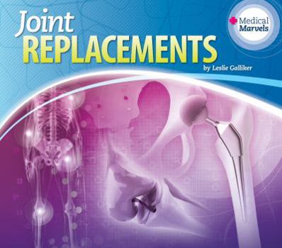 Joint Replacements - Book  of the Medical Marvels
