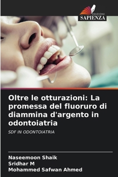 Oltre le otturazioni: La promessa del fluoruro di diammina d'argento in odontoiatria (Italian Edition)