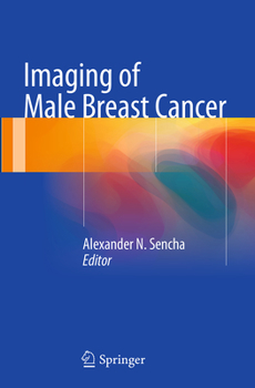 Paperback Imaging of Male Breast Cancer Book