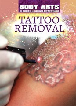 Paperback Tattoo Removal Book