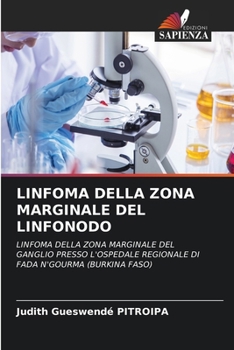 Paperback Linfoma Della Zona Marginale del Linfonodo [Italian] Book