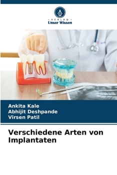 Verschiedene Arten von Implantaten (German Edition)