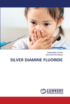 Paperback Silver Diamine Fluoride Book