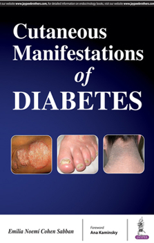 Paperback Cutaneous Manifestations of Diabetes Book