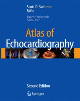 Hardcover Atlas of Echocardiography [With CDROM] Book