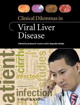 Paperback Clinical Dilemmas in Viral Liver Disease Book