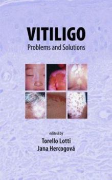 Hardcover Venous Thromboembolism (Lung Biology in Health and Disease) Book