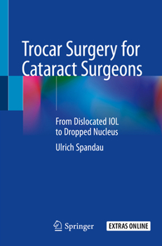 Paperback Trocar Surgery for Cataract Surgeons: From Dislocated Iol to Dropped Nucleus Book