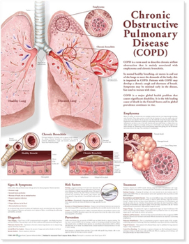 Wall Chart Chronic Obstructive Pulmonary Disease Anatomical Chart Book