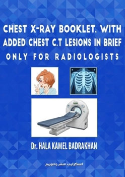 Paperback Chest X-Ray Booklet, with added Chest C.T Lesions in brief Only for Radiologists Book
