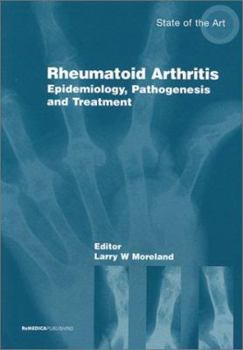 Paperback Management Rheumatoid Arthriti (ReMEDICA State of Art Series) Book
