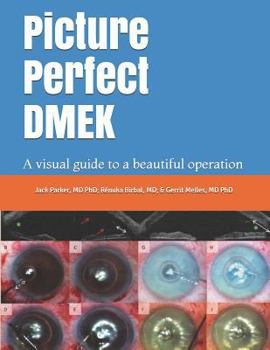 Paperback Picture Perfect DMEK: A visual guide to a beautiful operation Book