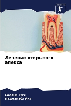 Paperback Лечение открытого апекс& [Russian] Book