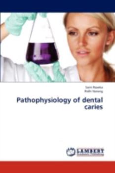 Paperback Pathophysiology of Dental Caries Book