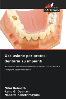 Occlusione per protesi dentaria su impianti (Italian Edition)