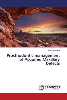 Paperback Prosthodontic management of Acquired Maxillary Defects Book