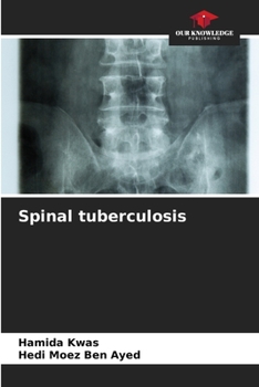 Paperback Spinal tuberculosis Book