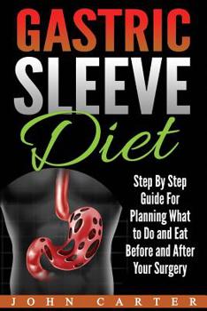 Paperback Gastric Sleeve Diet: Step By Step Guide For Planning What to Do and Eat Before and After Your Surgery Book
