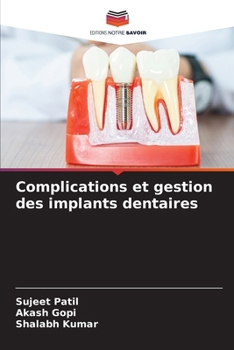 Complications et gestion des implants dentaires (French Edition)