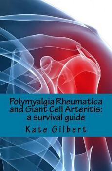 Paperback Polymyalgia Rheumatica and Giant Cell Arteritis: A Survival Guide Book