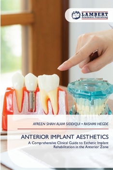 Paperback Anterior Implant Aesthetics Book