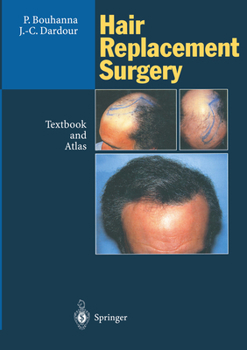 Paperback Hair Replacement Surgery: Textbook and Atlas Book