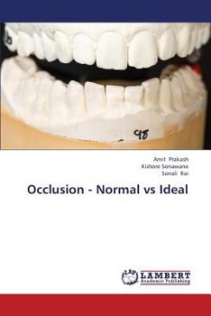 Paperback Occlusion - Normal Vs Ideal Book