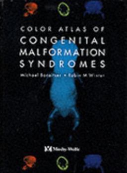 Color Atlas of Congenital Malformation Syndromes