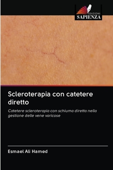 Paperback Scleroterapia con catetere diretto [Italian] Book