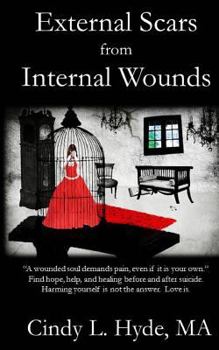 Paperback External Scars from Internal Wounds: Suicide is prevented when deep internal wounds are healed. Book