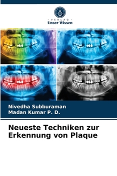 Paperback Neueste Techniken zur Erkennung von Plaque [German] Book